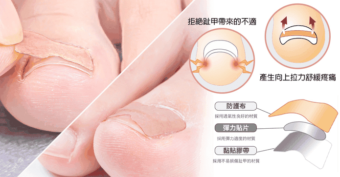 日本熱銷護腳彈力保護貼